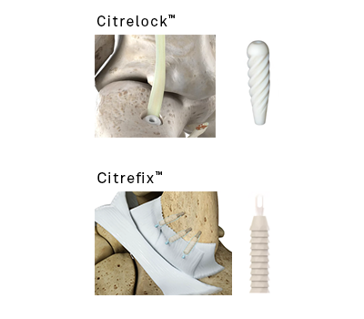 Citrelock and Citrefix