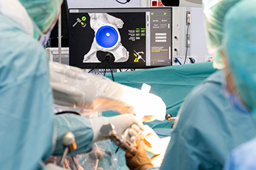 Doctors working with Mako SmartRobot